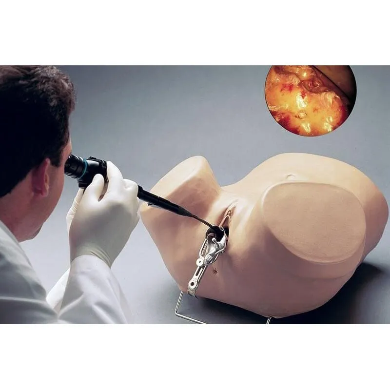 Hysteroscopy Simulator, Light